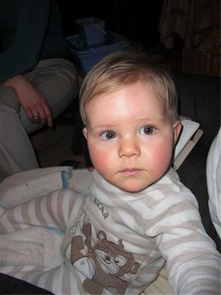 Photos